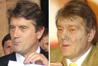 נשיא אוקראינה הנבחר ויקטור יושצ'נקו, לפני ואחרי הרעלת הדיוקסין בה אובחן.